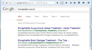 Encephalitis cure kl
