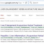 LIVER ENLARGEMENT3