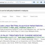 bell palsy 1
