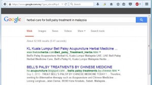 bell palsy 1