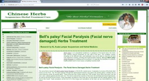 bell palsy 1 pge