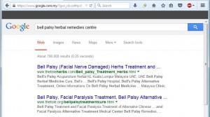 bell palsy 2