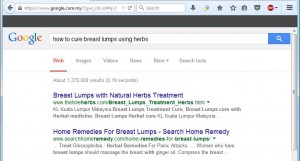 breast lumps 3